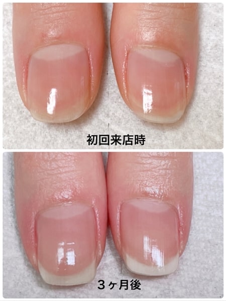 神奈川鎌倉ネイルサロン|縦爪になるネイルケア専門店なら溫